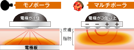 ラジオ波